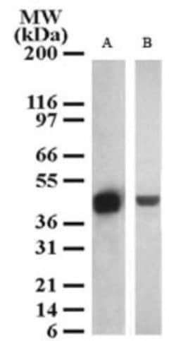 Invitrogen SETD7 Polyclonal Antibody 200 &mu;L; Unconjugated:Antibodies,