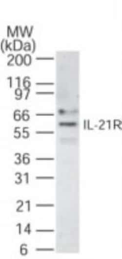 Invitrogen IL21R Polyclonal Antibody 200 &mu;L; Unconjugated:Antibodies,