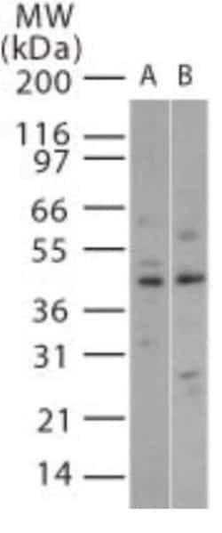 Invitrogen p38 MAPK beta Polyclonal Antibody 100 &mu;g; Unconjugated:Antibodies,
