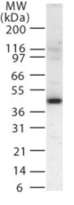 MEK2 Polyclonal Antibody, Invitrogen 100 &mu;g | Buy Online | Thermo Scientific | Fisher Scientific