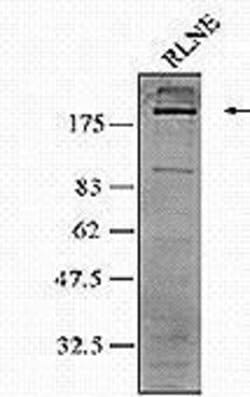 Invitrogen gp210 Polyclonal Antibody 50 &mu;L | Buy Online | Invitrogen&trade; | Fisher Scientific
