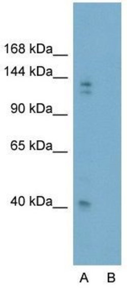 Invitrogen GLI2 Polyclonal Antibody 100 &mu;g; Unconjugated:Antibodies,