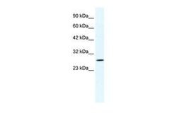 Invitrogen CLIC1 Polyclonal Antibody 100 &mu;g | Buy Online | Invitrogen&trade; | Fisher Scientific