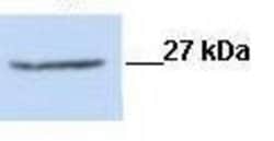 Invitrogen CLIC1 Polyclonal Antibody 100 &mu;g | Buy Online | Invitrogen&trade; | Fisher Scientific