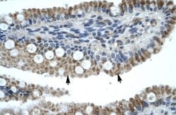 Invitrogen ZNF683 Polyclonal Antibody 100 &mu;g; Unconjugated:Antibodies,