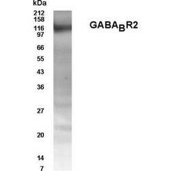 GABBR2 Polyclonal Antibody, Invitrogen 100 &mu;g; Unconjugated:Antibodies