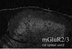 Invitrogen mGluR2/mGluR3 Polyclonal Antibody 100 &mu;g; Unconjugated:Antibodies,