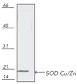 Invitrogen SOD1 Polyclonal Antibody 50 &mu;g | Buy Online | Invitrogen&trade; | Fisher Scientific