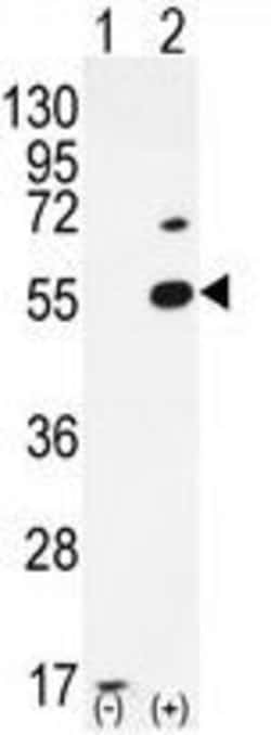 Invitrogen PRMT2 Polyclonal Antibody 400 &mu;L; Unconjugated:Antibodies,