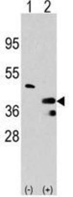 Invitrogen PRMT1 Polyclonal Antibody 400 &mu;L; Unconjugated:Antibodies,