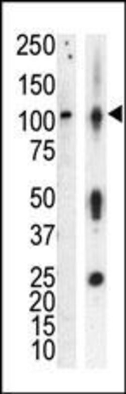 Invitrogen PRKD3 Polyclonal Antibody 400 &mu;L; Unconjugated:Antibodies,