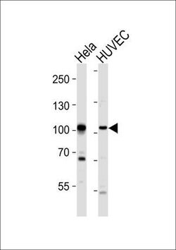 Invitrogen EphA4 Polyclonal Antibody 200 &mu;L; Unconjugated:Antibodies,