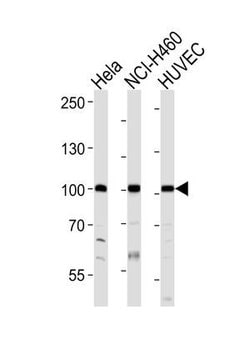 Invitrogen EphA4 Polyclonal Antibody 200 &mu;L; Unconjugated:Antibodies,