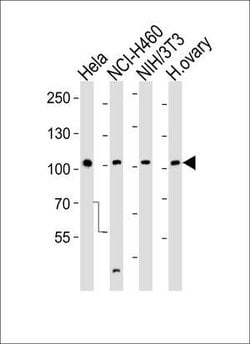 Invitrogen EphA4 Polyclonal Antibody 200 &mu;L; Unconjugated:Antibodies,