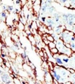 Invitrogen EphA7 Polyclonal Antibody 400 &mu;L; Unconjugated:Antibodies,