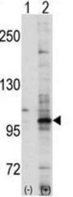 Invitrogen EphA7 Polyclonal Antibody 400 &mu;L; Unconjugated:Antibodies,