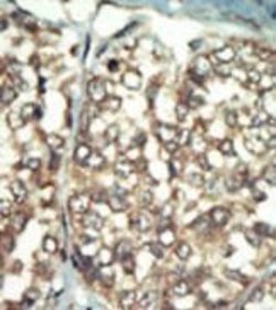 Invitrogen PI4K2B Polyclonal Antibody 400 &mu;L; Unconjugated:Antibodies,