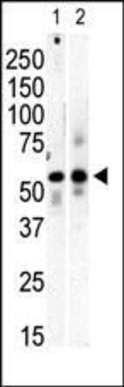 Invitrogen PI4K2B Polyclonal Antibody 400 &mu;L; Unconjugated:Antibodies,