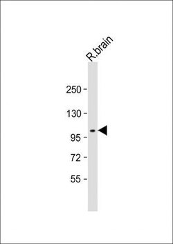 Invitrogen MCK10 Polyclonal Antibody 400 &mu;L; Unconjugated:Antibodies,