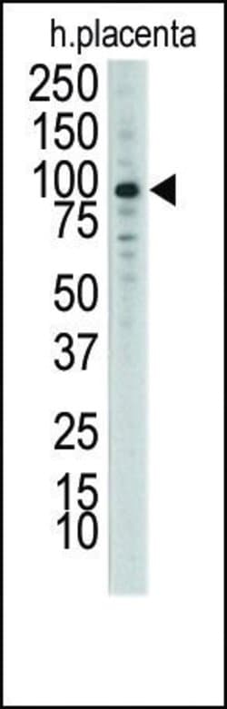 Invitrogen MCK10 Polyclonal Antibody 400 &mu;L; Unconjugated:Antibodies,