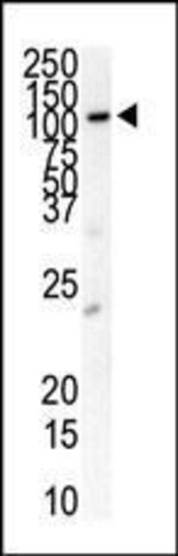 Invitrogen PDGFRB Polyclonal Antibody 400 &mu;L; Unconjugated:Antibodies,