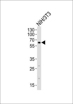 Invitrogen RYK Polyclonal Antibody 400 &mu;L; Unconjugated:Antibodies,
