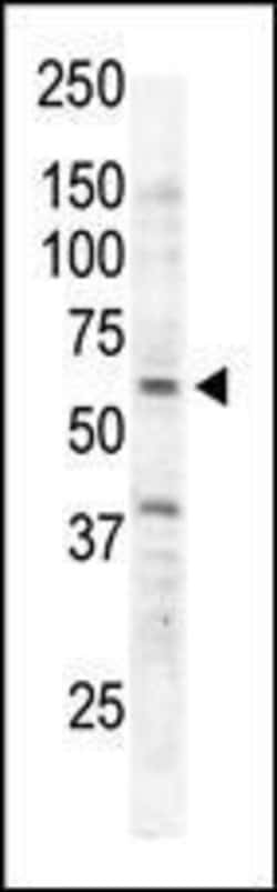 Invitrogen RYK Polyclonal Antibody 400 &mu;L; Unconjugated:Antibodies,