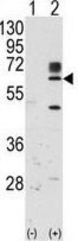 Invitrogen RYK Polyclonal Antibody 400 &mu;L; Unconjugated:Antibodies,