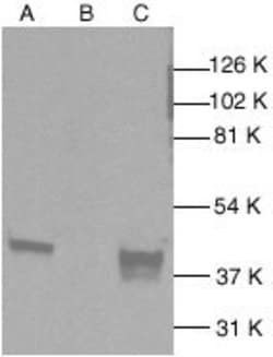 Invitrogen p38 MAPK Polyclonal Antibody 1 mL; Unconjugated:Antibodies,