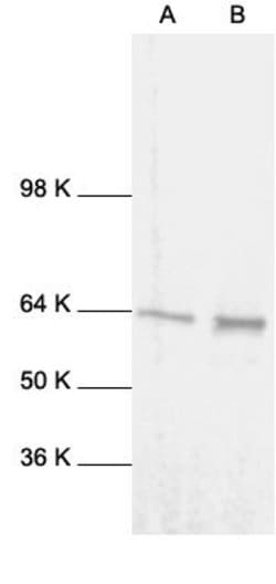 Invitrogen NFkB p65 Polyclonal Antibody 1 mL; Unconjugated:Anticuerpos