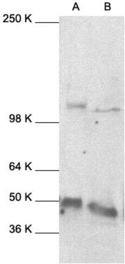 Invitrogen NFkB p105/p50 Polyclonal Antibody 1 mL | Buy Online | Invitrogen&trade; | Fisher Scientific