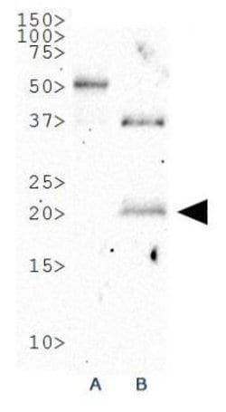 Invitrogen p19ARF Polyclonal Antibody 100 &mu;L; Unconjugated:Antibodies,