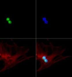 Invitrogen p19ARF Polyclonal Antibody 100 &mu;L; Unconjugated:Antibodies,