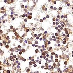 Invitrogen p19ARF Polyclonal Antibody 100 &mu;L; Unconjugated:Antibodies,