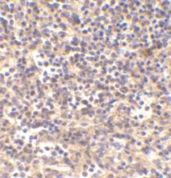 Invitrogen DNase II Polyclonal Antibody 100 &mu;g; Unconjugated:Antibodies,