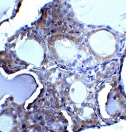 Invitrogen DNase II Polyclonal Antibody 100 &mu;g; Unconjugated:Antibodies,