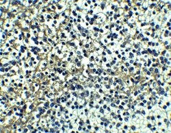 Invitrogen DR4 Polyclonal Antibody 100 &mu;g | Buy Online | Invitrogen&trade; | Fisher Scientific