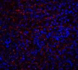 Invitrogen DR4 Polyclonal Antibody 100 &mu;g | Buy Online | Invitrogen&trade; | Fisher Scientific