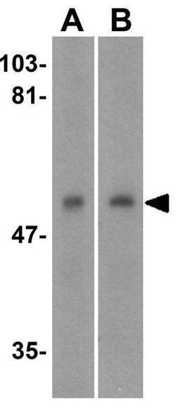 Invitrogen DR4 Polyclonal Antibody 100 &mu;g | Buy Online | Invitrogen&trade; | Fisher Scientific