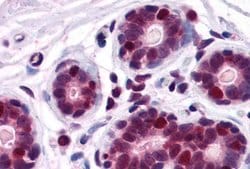 Invitrogen DDX5 Polyclonal Antibody 100 &mu;g; Unconjugated:Anticuerpos