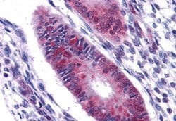 Invitrogen DDX5 Polyclonal Antibody 100 &mu;g; Unconjugated:Anticuerpos