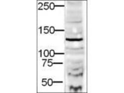 Invitrogen DIAPH2 Polyclonal Antibody 50 &mu;g; Unconjugated:Antibodies,