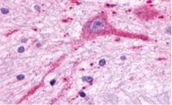 Invitrogen MCHR2 Polyclonal Antibody 25 &mu;g; Unconjugated:Antibodies,