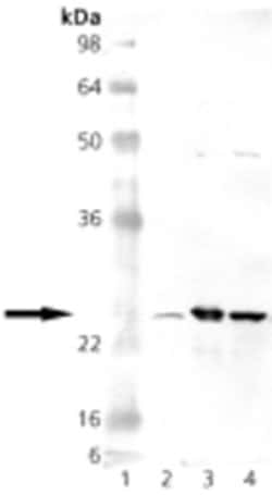 Invitrogen SOD2 Polyclonal Antibody 50 &mu;g; Unconjugated:Antibodies,