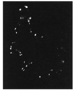 Invitrogen PDE4A Polyclonal Antibody 100 &mu;g; Unconjugated:Antibodies,