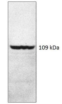 Invitrogen PDE4A Polyclonal Antibody 100 &mu;g; Unconjugated:Antibodies,