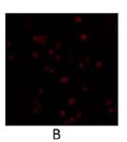 Invitrogen PDE4B Polyclonal Antibody 100 &mu;g; Unconjugated:Antibodies,