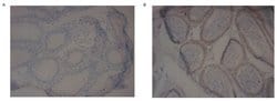 PDE10A Polyclonal Antibody, Invitrogen 100 &mu;g; Unconjugated:Antibodies,