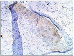 PDE10A Polyclonal Antibody, Invitrogen 100 &mu;g; Unconjugated:Antibodies,