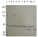 PDE10A Polyclonal Antibody, Invitrogen™